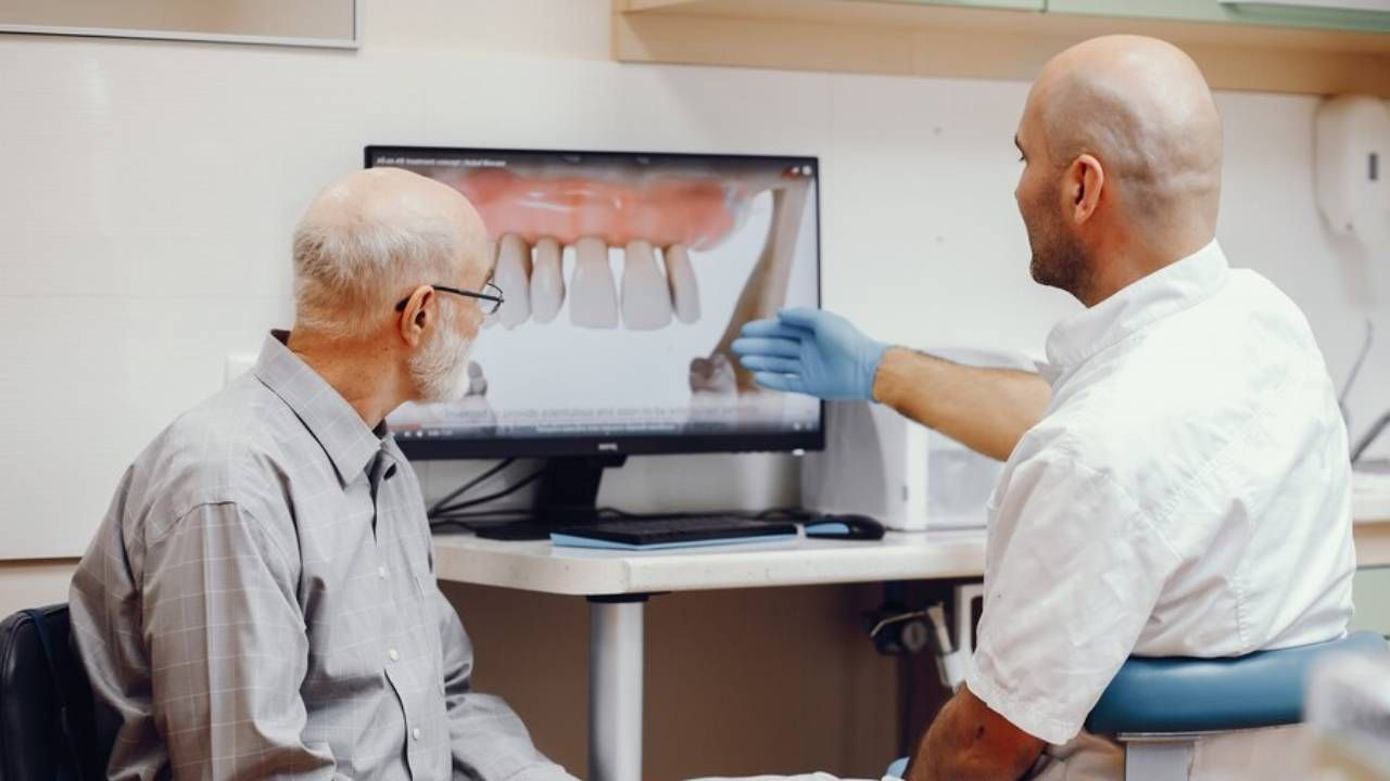 Implantes dentales de boca completa en Madrid: ¿qué debes saber?