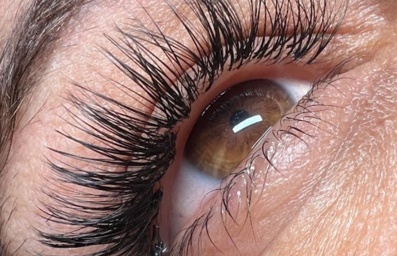 Foto: Glanz Estetica Integral By Francis Angulo