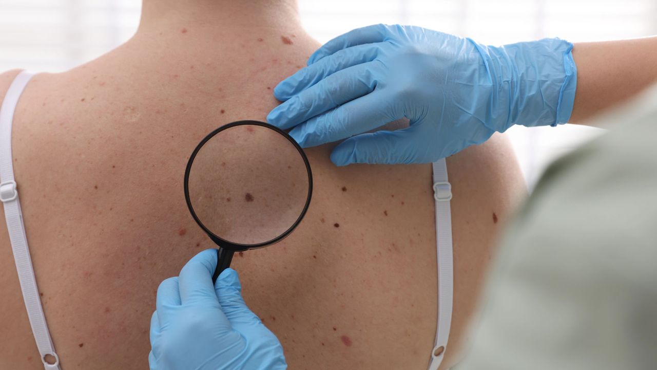 Cómo elegir a un buen dermatólogo en Madrid