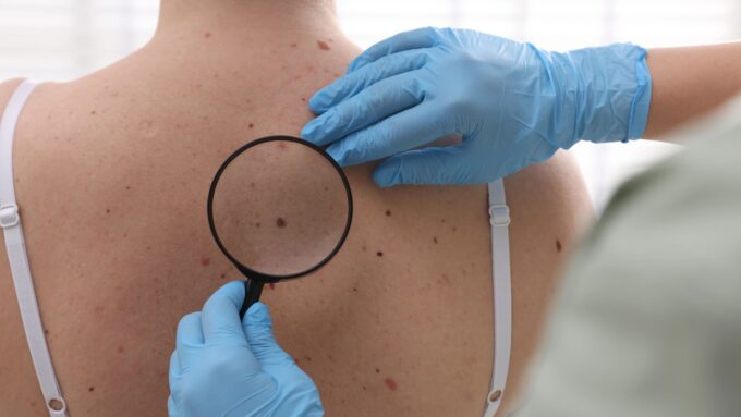 Cómo elegir a un buen dermatólogo en Madrid